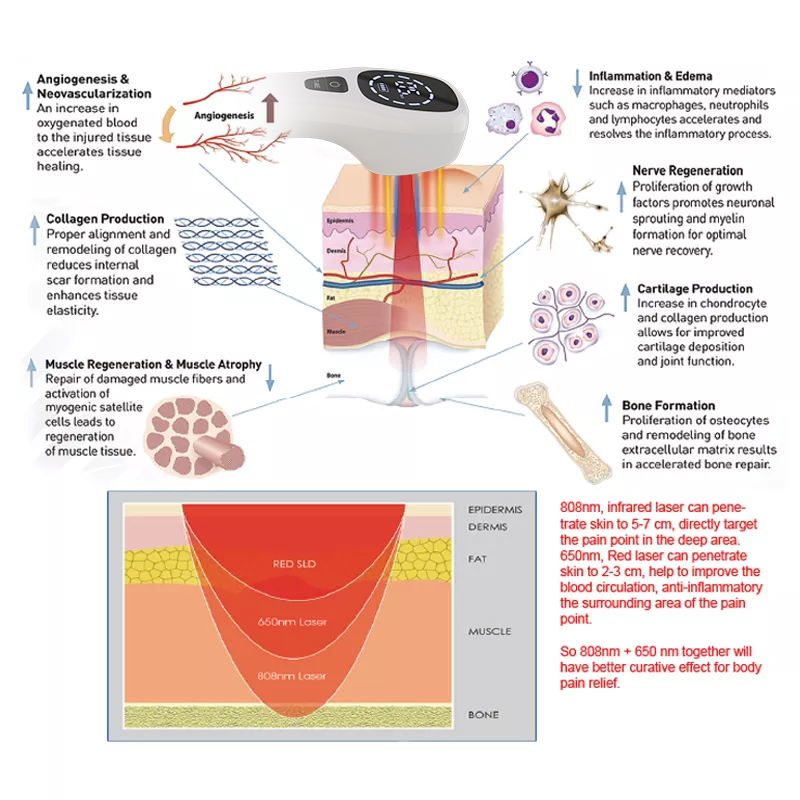 Dispositivo de terapia a laser - Badminton Bag avaliação e preço